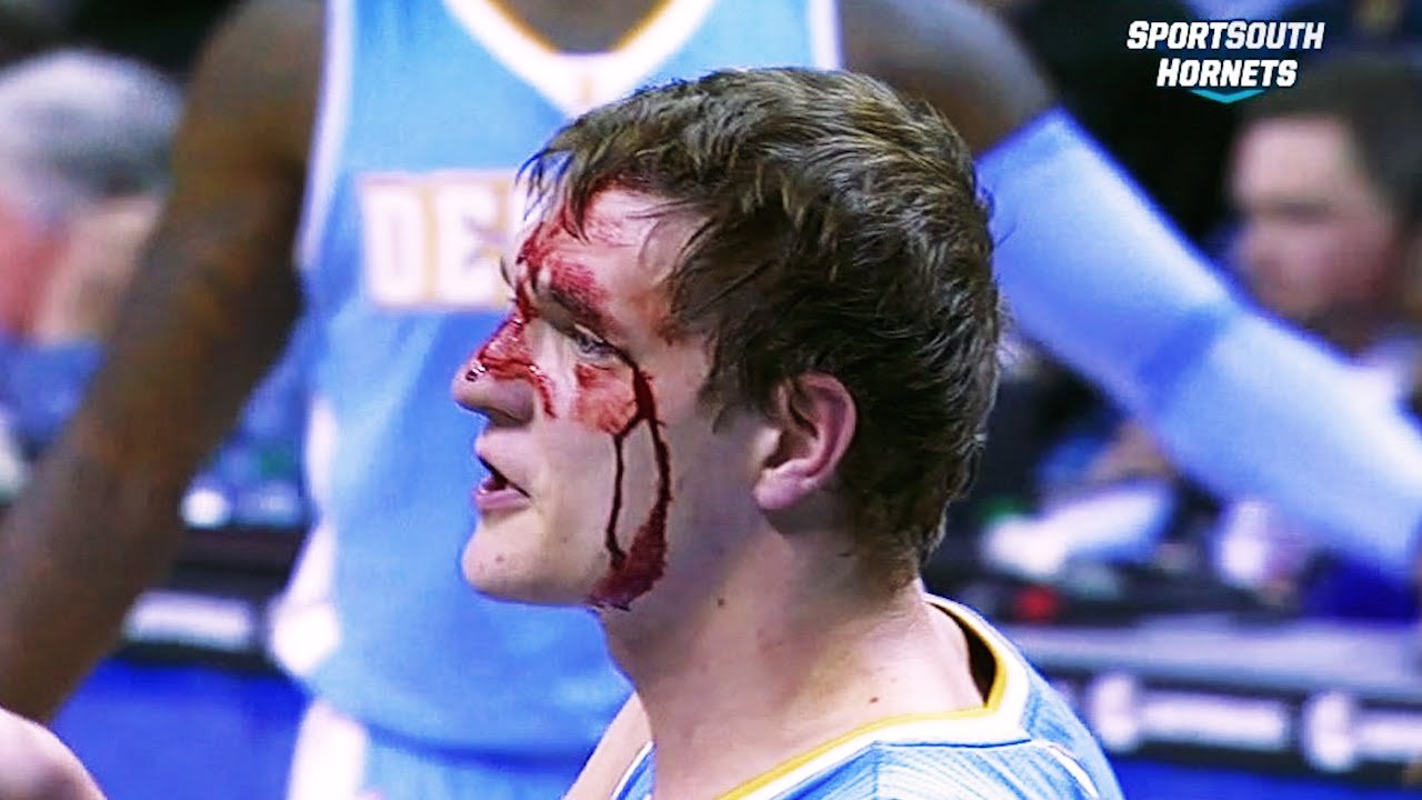 Vidéo : les blessures les plus douloureuses de la saison